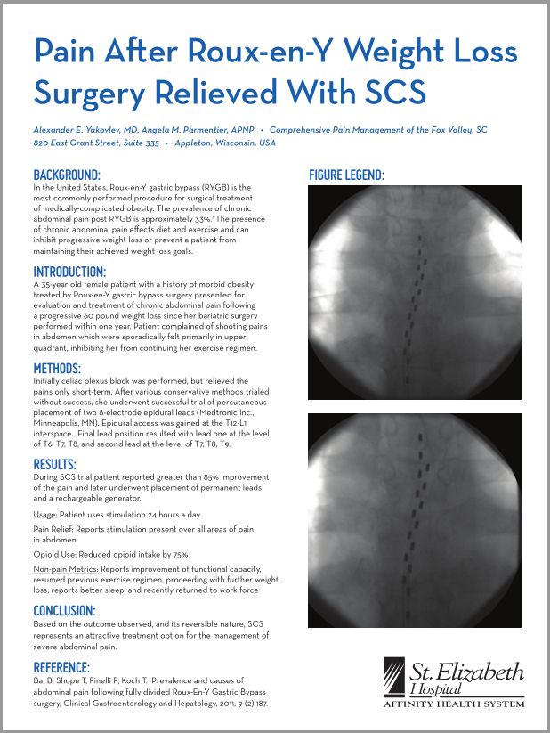 Pain After Roux-en-Y Weight Loss Surgery Relieved With SCS.PNG