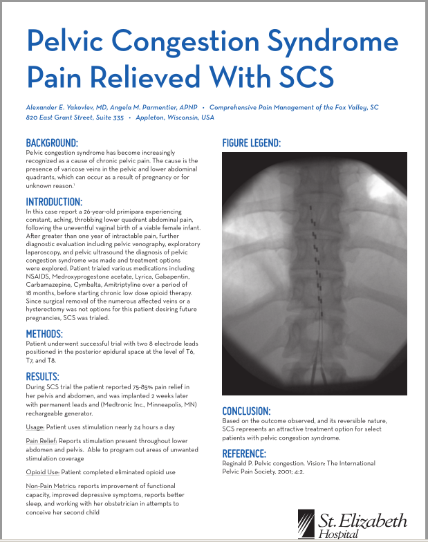 Pelvic Congestion Syndrome Pain Relieved With SCS.PNG